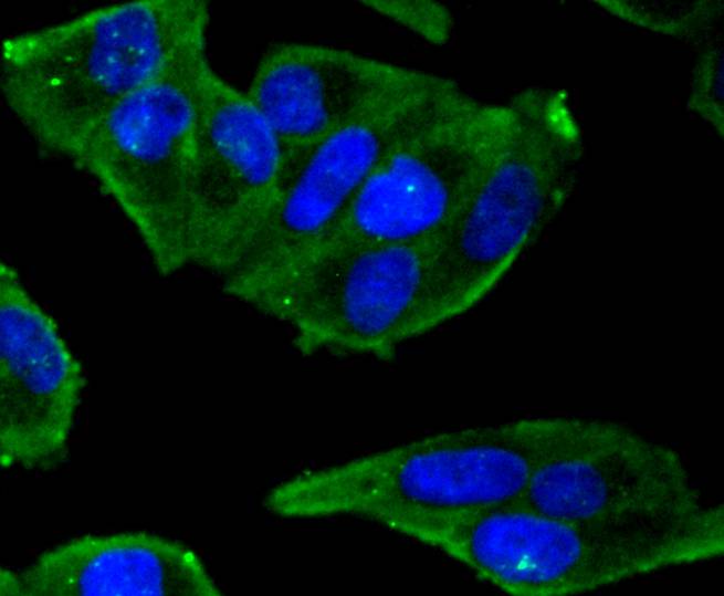 ICC staining of Phospho-Estrogen Receptor alpha(S118) in Hela cells (green). Formalin fixed cells were permeabilized with 0.1% Triton X-100 in TBS for 10 minutes at room temperature and blocked with 10% negative goat serum for 15 minutes at room temperature. Cells were probed with the primary antibody (ET1610-32, 1/50) for 1 hour at room temperature, washed with PBS. Alexa Fluor®488 conjugate-Goat anti-Rabbit IgG was used as the secondary antibody at 1/1,000 dilution. The nuclear counter stain is DAPI (blue).