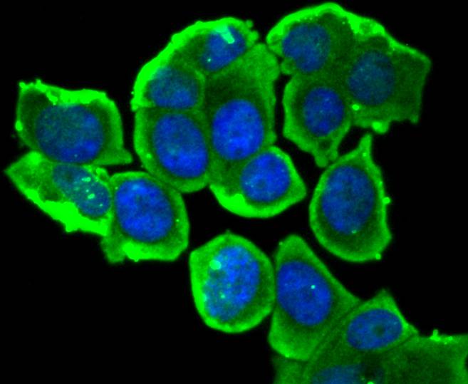 ICC staining of Phospho-Estrogen Receptor alpha(S118) in MCF-7 cells (green). Formalin fixed cells were permeabilized with 0.1% Triton X-100 in TBS for 10 minutes at room temperature and blocked with 10% negative goat serum for 15 minutes at room temperature. Cells were probed with the primary antibody (ET1610-32, 1/50) for 1 hour at room temperature, washed with PBS. Alexa Fluor®488 conjugate-Goat anti-Rabbit IgG was used as the secondary antibody at 1/1,000 dilution. The nuclear counter stain is DAPI (blue).