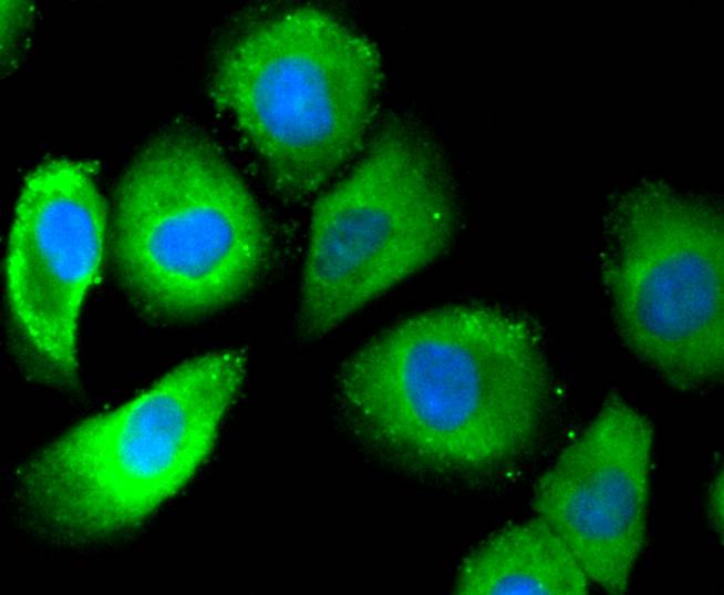 ICC staining of Phospho-Estrogen Receptor alpha(S118) in HUVEC cells (green). Formalin fixed cells were permeabilized with 0.1% Triton X-100 in TBS for 10 minutes at room temperature and blocked with 10% negative goat serum for 15 minutes at room temperature. Cells were probed with the primary antibody (ET1610-32, 1/50) for 1 hour at room temperature, washed with PBS. Alexa Fluor®488 conjugate-Goat anti-Rabbit IgG was used as the secondary antibody at 1/1,000 dilution. The nuclear counter stain is DAPI (blue).