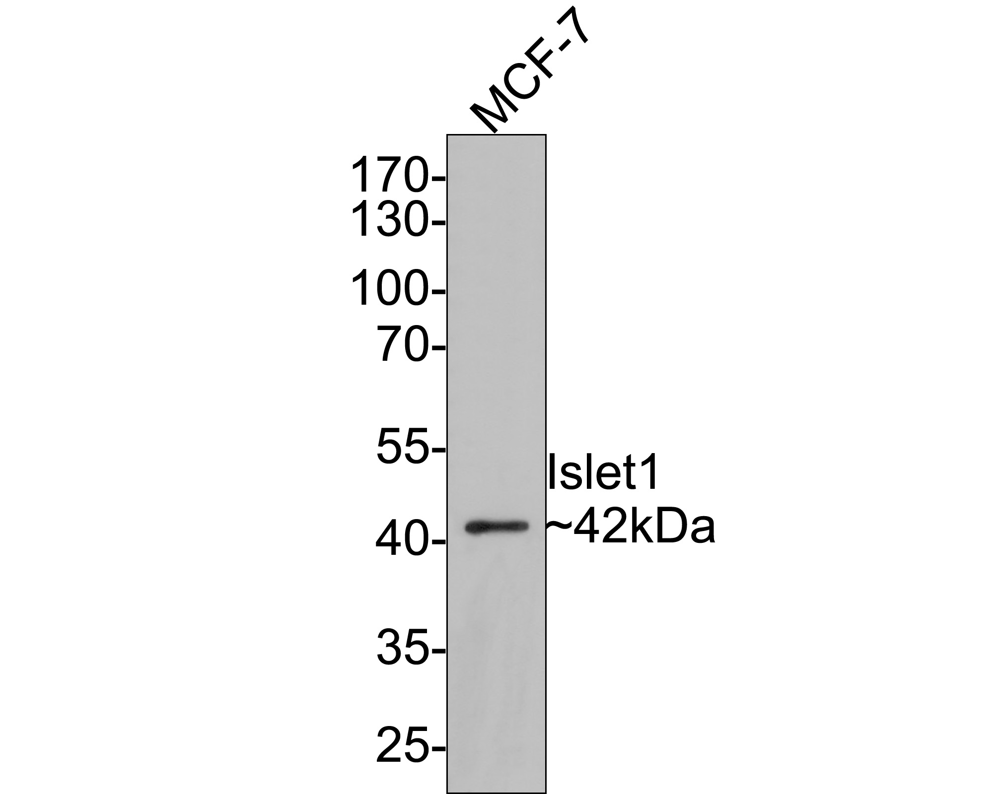 Western blot analysis of Islet 1 on MCF-7 cell lysates with Rabbit anti-Islet 1 antibody (ET1610-33) at 1/500 dilution.<br />
<br />
Lysates/proteins at 10 µg/Lane.<br />
<br />
Predicted band size: 39 kDa<br />
Observed band size: 42 kDa<br />
<br />
Exposure time: 2 minutes;<br />
<br />
10% SDS-PAGE gel.<br />
<br />
Proteins were transferred to a PVDF membrane and blocked with 5% NFDM/TBST for 1 hour at room temperature. The primary antibody (ET1610-33) at 1/500 dilution was used in 5% NFDM/TBST at room temperature for 2 hours. Goat Anti-Rabbit IgG - HRP Secondary Antibody (HA1001) at 1:300,000 dilution was used for 1 hour at room temperature.