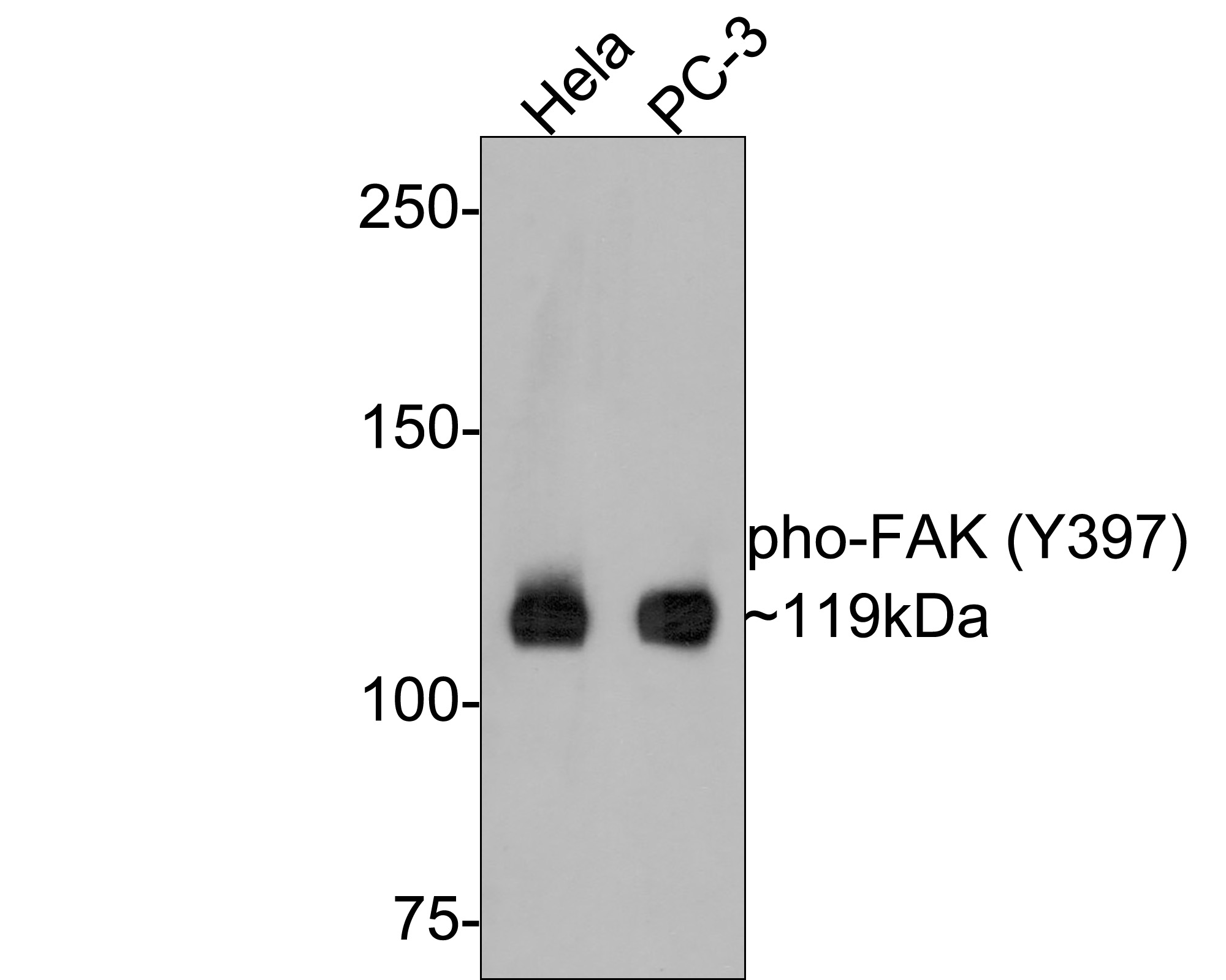Western blot analysis of Phospho-FAK (Y397) on different lysates with Rabbit anti-Phospho-FAK (Y397) antibody (ET1610-34) at 1/500 dilution.<br />
<br />
Lane 1: Hela cell lysate<br />
Lane 2: PC-3 cell lysate<br />
<br />
Lysates/proteins at 10 µg/Lane.<br />
<br />
Predicted band size: 119 kDa<br />
Observed band size: 119 kDa<br />
<br />
Exposure time: 2 minutes;<br />
<br />
6% SDS-PAGE gel.<br />
<br />
Proteins were transferred to a PVDF membrane and blocked with 5% NFDM/TBST for 1 hour at room temperature. The primary antibody (ET1610-34) at 1/500 dilution was used in 5% NFDM/TBST at room temperature for 2 hours. Goat Anti-Rabbit IgG - HRP Secondary Antibody (HA1001) at 1:300,000 dilution was used for 1 hour at room temperature.