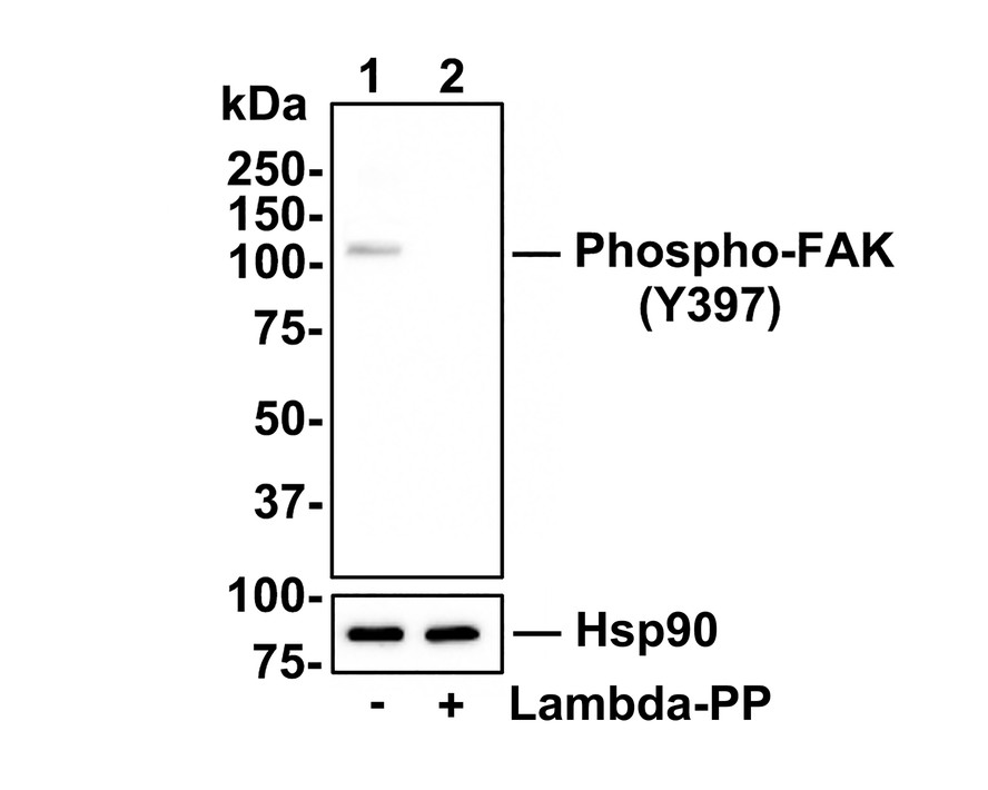 Western blot analysis of Phospho-FAK (Y397) on Hela cell lysates.<br />
<br />
Lane 1: Hela cells, whole cell lysate, 10ug/lane<br />
Lane 2: Hela cells treated with 2.8ug/ul lambda-PP for 30 minutes, whole cell lysates, 10ug/lane<br />
<br />
All lanes :<br />
Anti-Phospho-FAK (Y397) antibody (ET1610-34) at 1:500 dilution. Anti-Hsp90 antibody (ET1605-56) at 1:10,000 dilution. Goat Anti-Rabbit IgG H&L (HRP) (HA1001) at 1/200,000 dilution.<br />
<br />
Predicted band size: 119 kDa<br />
Observed band size: 119 kDa<br />
<br />
Blocking and diluting buffer: 5% BSA.<br />
<br />
Exposure time: 30 seconds