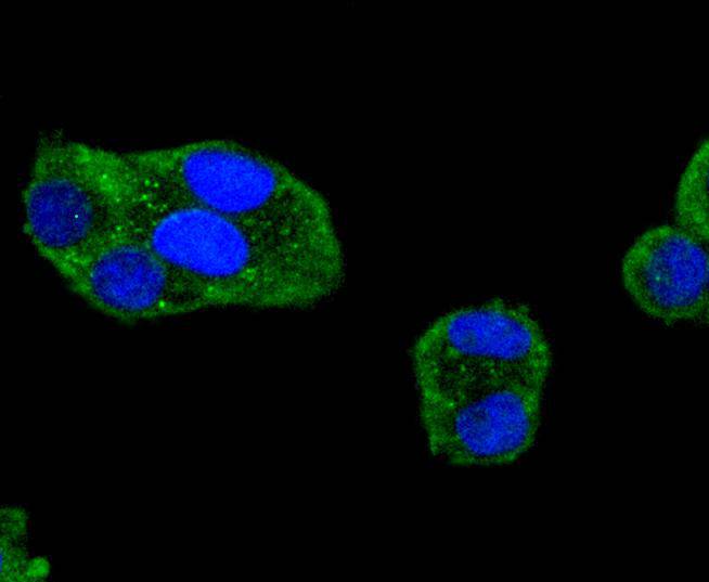 ICC staining of Phospho-FAK (Y397) in Hela cells (green). Formalin fixed cells were permeabilized with 0.1% Triton X-100 in TBS for 10 minutes at room temperature and blocked with 1% Blocker BSA for 15 minutes at room temperature. Cells were probed with the primary antibody (ET1610-34, 1/50) for 1 hour at room temperature, washed with PBS. Alexa Fluor®488 Goat anti-Rabbit IgG was used as the secondary antibody at 1/1,000 dilution. The nuclear counter stain is DAPI (blue).