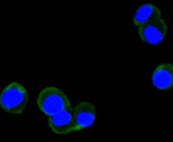 ICC staining of Phospho-FAK (Y397) in N2A cells (green). Formalin fixed cells were permeabilized with 0.1% Triton X-100 in TBS for 10 minutes at room temperature and blocked with 1% Blocker BSA for 15 minutes at room temperature. Cells were probed with the primary antibody (ET1610-34, 1/50) for 1 hour at room temperature, washed with PBS. Alexa Fluor®488 Goat anti-Rabbit IgG was used as the secondary antibody at 1/1,000 dilution. The nuclear counter stain is DAPI (blue).