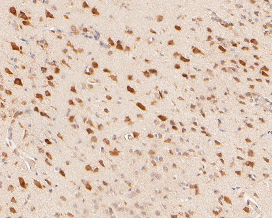 Immunohistochemical analysis of paraffin-embedded mouse cerebellum tissue using anti-Tryptophan Hydroxylase 1 (TPH1) antibody. The section was pre-treated using heat mediated antigen retrieval with Tris-EDTA buffer (pH 8.0-8.4) for 20 minutes.The tissues were blocked in 5% BSA for 30 minutes at room temperature, washed with ddH2O and PBS, and then probed with the primary antibody (ET1610-37, 1/50) for 30 minutes at room temperature. The detection was performed using an HRP conjugated compact polymer system. DAB was used as the chromogen. Tissues were counterstained with hematoxylin and mounted with DPX.