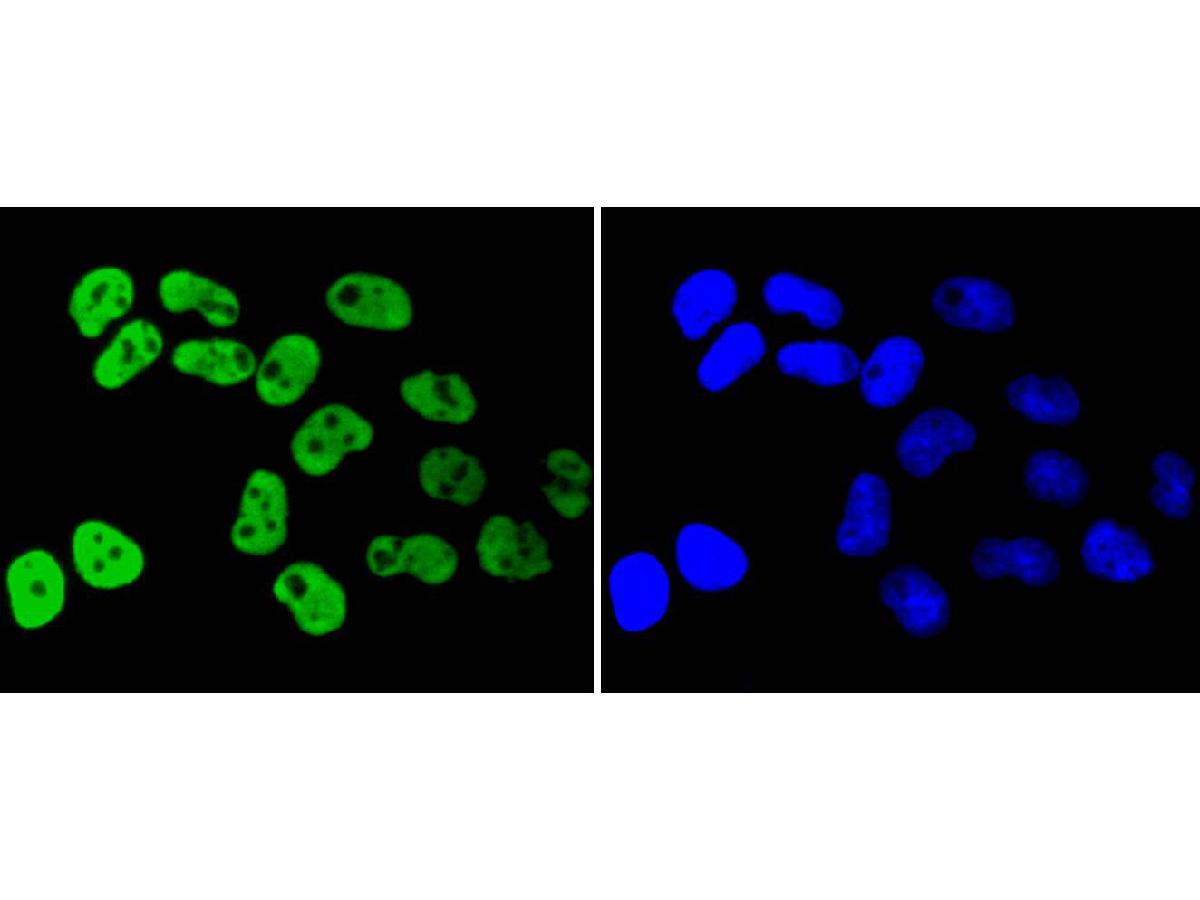 ICC staining of hnRNP K in Hela cells (green). Formalin fixed cells were permeabilized with 0.1% Triton X-100 in TBS for 10 minutes at room temperature and blocked with 1% Blocker BSA for 15 minutes at room temperature. Cells were probed with the primary antibody (ET1610-38, 1/50) for 1 hour at room temperature, washed with PBS. Alexa Fluor®488 Goat anti-Rabbit IgG was used as the secondary antibody at 1/1,000 dilution. The nuclear counter stain is DAPI (blue).