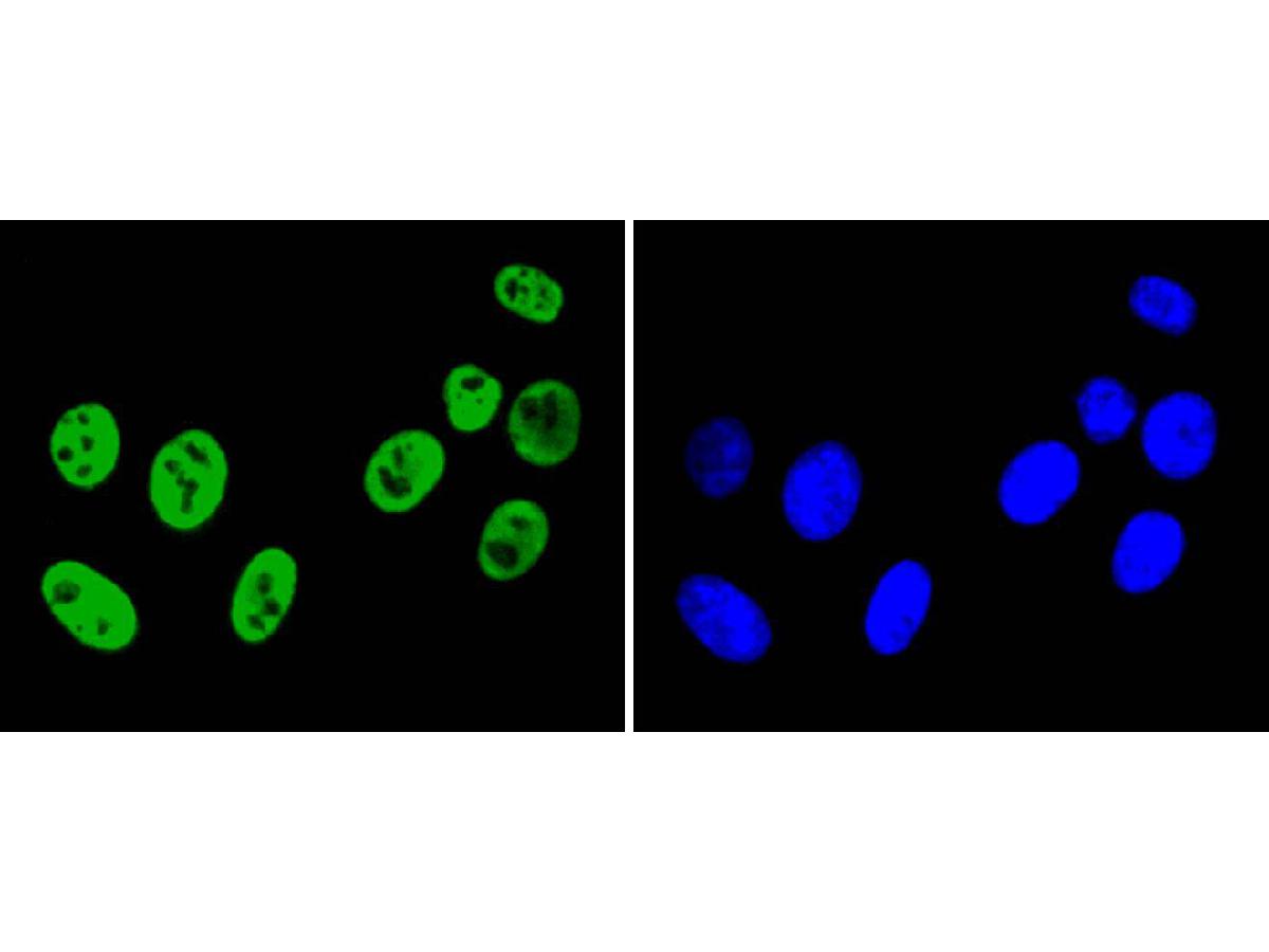 ICC staining of hnRNP K in HepG2 cells (green). Formalin fixed cells were permeabilized with 0.1% Triton X-100 in TBS for 10 minutes at room temperature and blocked with 1% Blocker BSA for 15 minutes at room temperature. Cells were probed with the primary antibody (ET1610-38, 1/100) for 1 hour at room temperature, washed with PBS. Alexa Fluor®488 Goat anti-Rabbit IgG was used as the secondary antibody at 1/1,000 dilution. The nuclear counter stain is DAPI (blue).