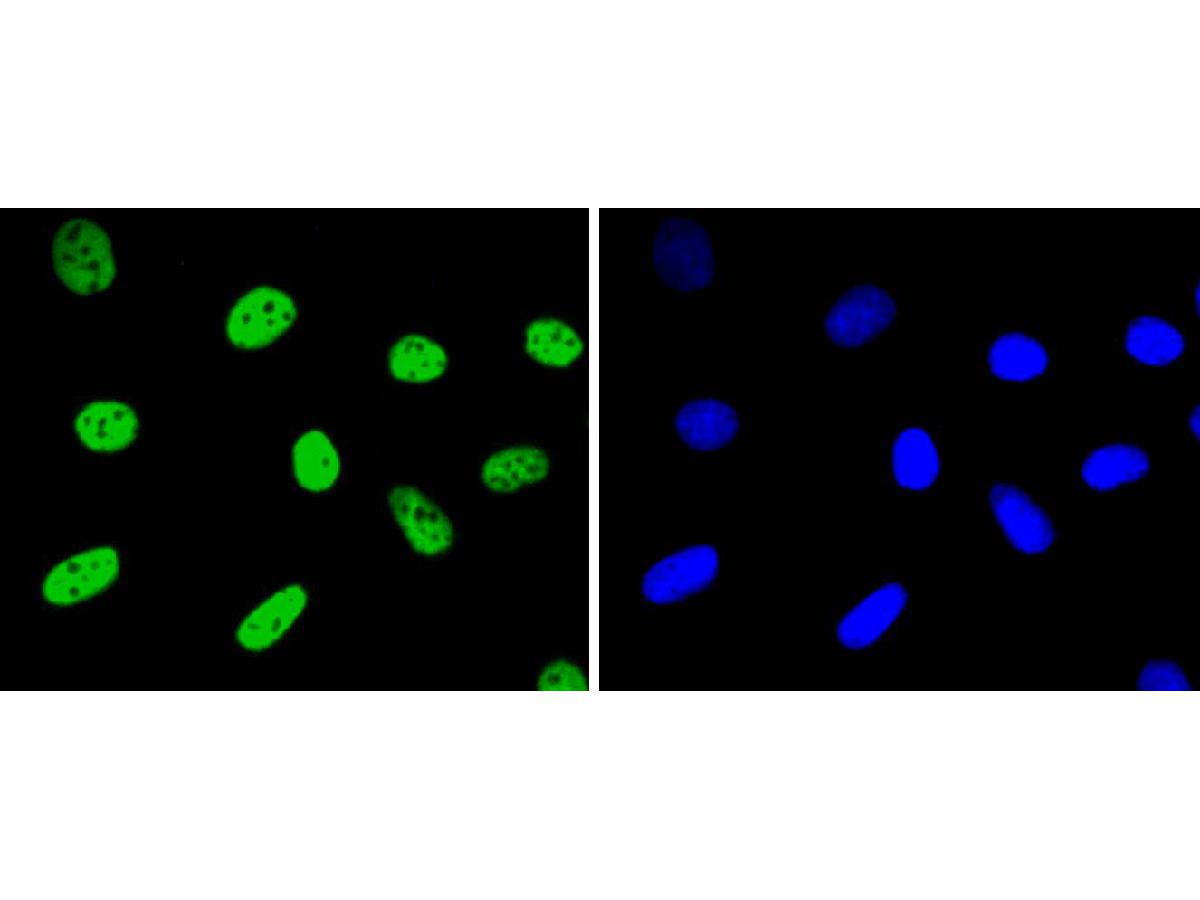 ICC staining of hnRNP K in SKOV-3 cells (green). Formalin fixed cells were permeabilized with 0.1% Triton X-100 in TBS for 10 minutes at room temperature and blocked with 1% Blocker BSA for 15 minutes at room temperature. Cells were probed with the primary antibody (ET1610-38, 1/100) for 1 hour at room temperature, washed with PBS. Alexa Fluor®488 Goat anti-Rabbit IgG was used as the secondary antibody at 1/1,000 dilution. The nuclear counter stain is DAPI (blue).