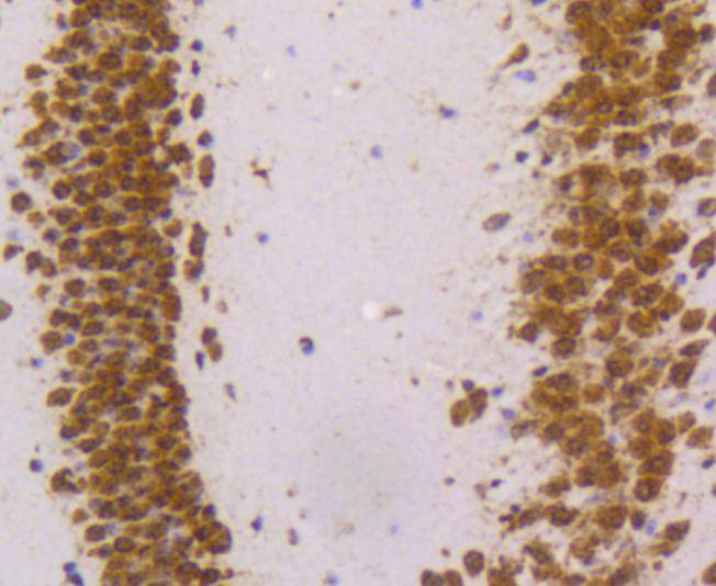 Immunohistochemical analysis of paraffin-embedded mouse brain tissue using anti-hnRNP K antibody. The section was pre-treated using heat mediated antigen retrieval with Tris-EDTA buffer (pH 8.0-8.4) for 20 minutes.The tissues were blocked in 5% BSA for 30 minutes at room temperature, washed with ddH2O and PBS, and then probed with the primary antibody (ET1610-38, 1/50) for 30 minutes at room temperature. The detection was performed using an HRP conjugated compact polymer system. DAB was used as the chromogen. Tissues were counterstained with hematoxylin and mounted with DPX.