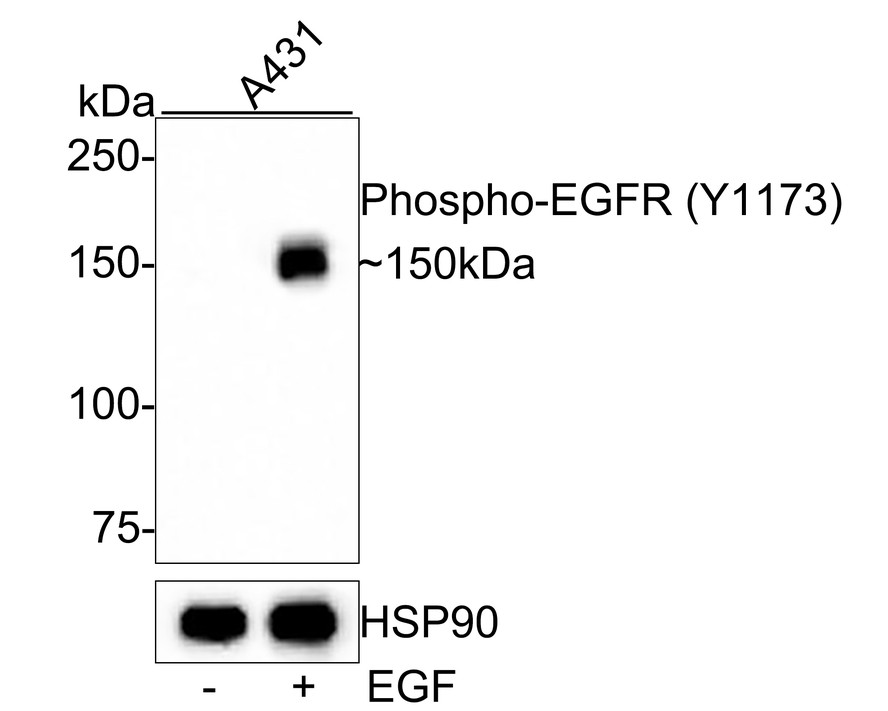 Western blot analysis of Phospho-EGFR (Y1173) on different lysates with Rabbit anti-Phospho-EGFR (Y1173) antibody (ET1610-4) at 1/500 dilution.<br />
<br />
Lane 1: A431 whole cell lysate<br />
Lane 2: A431 treated with 100ng/mL EGF for 30 minutes whole cell lysate<br />
<br />
Lysates/proteins at 10 µg/Lane.<br />
<br />
Predicted band size: 135 kDa<br />
Observed band size: 150 kDa<br />
<br />
Exposure time: 1 minute;<br />
<br />
6% SDS-PAGE gel.<br />
<br />
Proteins were transferred to a PVDF membrane and blocked with 5% NFDM/TBST for 1 hour at room temperature. The primary antibody (ET1610-4) at 1/500 dilution was used in 5% NFDM/TBST at room temperature for 2 hours. Goat Anti-Rabbit IgG - HRP Secondary Antibody (HA1001) at 1:200,000 dilution was used for 1 hour at room temperature.