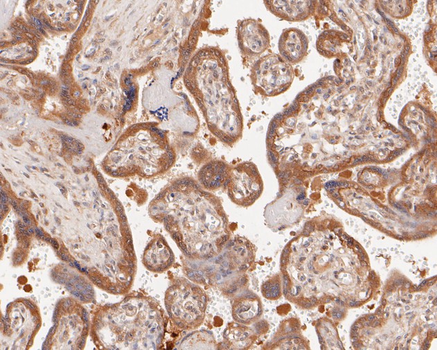 ICC staining of Phospho-EGFR (Y1173) in untreated B16F1 cells (green). Formalin fixed cells were permeabilized with 0.1% Triton X-100 in TBS for 10 minutes at room temperature and blocked with 1% Blocker BSA for 15 minutes at room temperature. Cells were probed with the primary antibody (ET1610-4, 1/50) for 1 hour at room temperature, washed with PBS. Alexa Fluor®488 Goat anti-Rabbit IgG was used as the secondary antibody at 1/1,000 dilution. The nuclear counter stain is DAPI (blue).