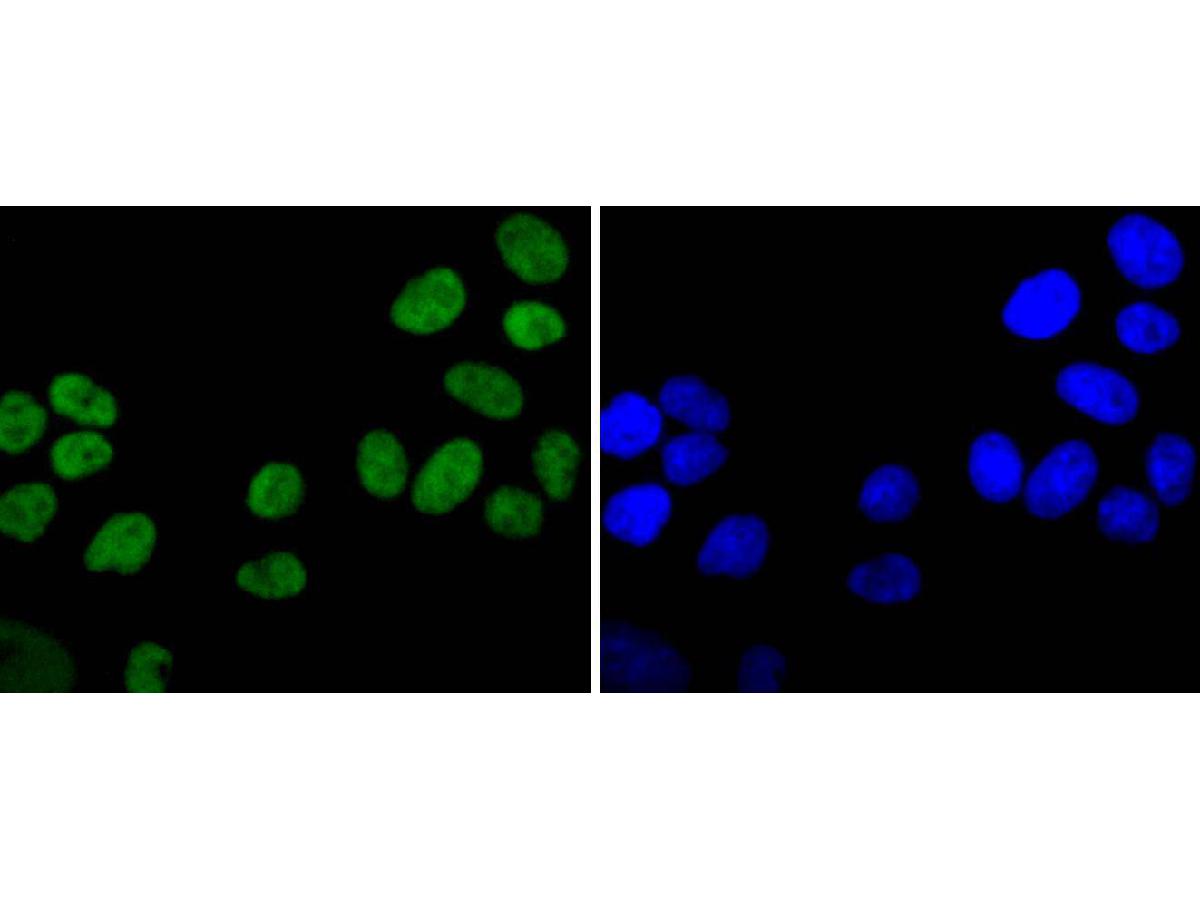ICC staining of Ku80 in Hela cells (green). Formalin fixed cells were permeabilized with 0.1% Triton X-100 in TBS for 10 minutes at room temperature and blocked with 1% Blocker BSA for 15 minutes at room temperature. Cells were probed with the primary antibody (ET1610-40, 1/50) for 1 hour at room temperature, washed with PBS. Alexa Fluor®488 Goat anti-Rabbit IgG was used as the secondary antibody at 1/1,000 dilution. The nuclear counter stain is DAPI (blue).