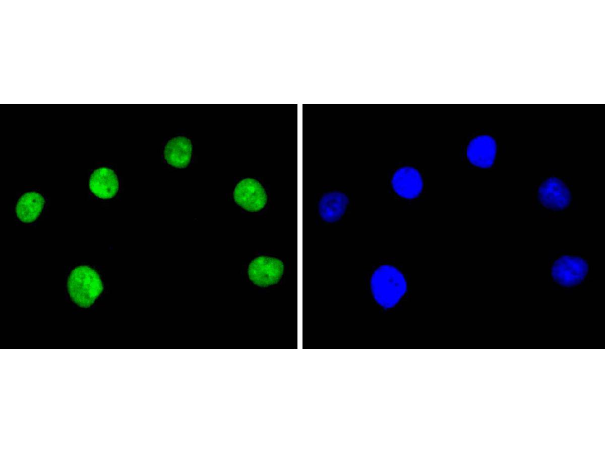 ICC staining of Ku80 in A549 cells (green). Formalin fixed cells were permeabilized with 0.1% Triton X-100 in TBS for 10 minutes at room temperature and blocked with 1% Blocker BSA for 15 minutes at room temperature. Cells were probed with the primary antibody (ET1610-40, 1/50) for 1 hour at room temperature, washed with PBS. Alexa Fluor®488 Goat anti-Rabbit IgG was used as the secondary antibody at 1/1,000 dilution. The nuclear counter stain is DAPI (blue).