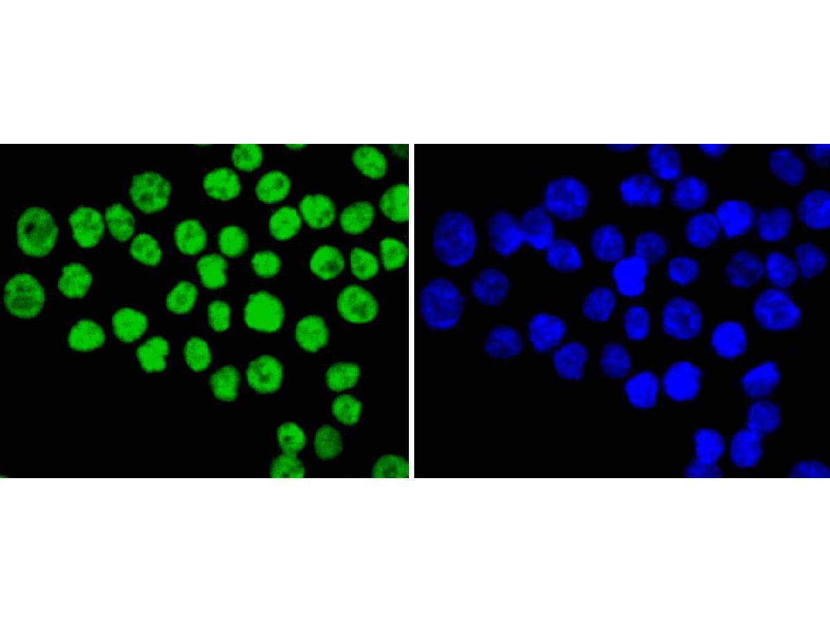 ICC staining of Ku80 in SW480 cells (green). Formalin fixed cells were permeabilized with 0.1% Triton X-100 in TBS for 10 minutes at room temperature and blocked with 1% Blocker BSA for 15 minutes at room temperature. Cells were probed with the primary antibody (ET1610-40, 1/50) for 1 hour at room temperature, washed with PBS. Alexa Fluor®488 Goat anti-Rabbit IgG was used as the secondary antibody at 1/1,000 dilution. The nuclear counter stain is DAPI (blue).