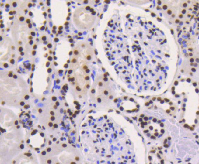 Immunohistochemical analysis of paraffin-embedded human kideny tissue using anti-Ku80 antibody. Counter stained with hematoxylin.<br />
<br />
Immunohistochemical analysis of paraffin-embedded human kideny tissue with Rabbit anti-Ku80 antibody (ET1610-40) at 1/50 dilution.<br />
<br />
The section was pre-treated using heat mediated antigen retrieval with Tris-EDTA buffer (pH 8.0-8.4) for 20 minutes. The tissues were blocked in 1% BSA for 20 minutes at room temperature, washed with ddH2O and PBS, and then probed with the primary antibody (ET1610-40) at 1/50 dilution for 1 hour at room temperature. The detection was performed using an HRP conjugated compact polymer system. DAB was used as the chromogen. Tissues were counterstained with hematoxylin and mounted with DPX.