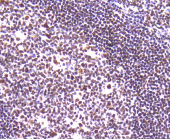 Immunohistochemical analysis of paraffin-embedded human tonsil tissue with Rabbit anti-Ku80 antibody (ET1610-40) at 1/50 dilution.<br />
<br />
The section was pre-treated using heat mediated antigen retrieval with Tris-EDTA buffer (pH 8.0-8.4) for 20 minutes. The tissues were blocked in 1% BSA for 20 minutes at room temperature, washed with ddH2O and PBS, and then probed with the primary antibody (ET1610-40) at 1/50 dilution for 1 hour at room temperature. The detection was performed using an HRP conjugated compact polymer system. DAB was used as the chromogen. Tissues were counterstained with hematoxylin and mounted with DPX.