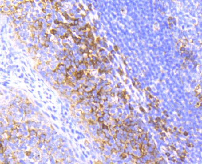 Immunohistochemical analysis of paraffin-embedded human tonsil tissue using anti-Radixin antibody. The section was pre-treated using heat mediated antigen retrieval with Tris-EDTA buffer (pH 8.0-8.4) for 20 minutes.The tissues were blocked in 5% BSA for 30 minutes at room temperature, washed with ddH2O and PBS, and then probed with the primary antibody (ET1610-41, 1/50) for 30 minutes at room temperature. The detection was performed using an HRP conjugated compact polymer system. DAB was used as the chromogen. Tissues were counterstained with hematoxylin and mounted with DPX.