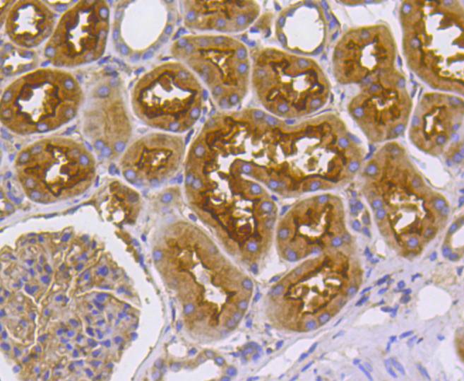 Immunohistochemical analysis of paraffin-embedded human kidney tissue using anti-Radixin antibody. The section was pre-treated using heat mediated antigen retrieval with Tris-EDTA buffer (pH 8.0-8.4) for 20 minutes.The tissues were blocked in 5% BSA for 30 minutes at room temperature, washed with ddH2O and PBS, and then probed with the primary antibody (ET1610-41, 1/50) for 30 minutes at room temperature. The detection was performed using an HRP conjugated compact polymer system. DAB was used as the chromogen. Tissues were counterstained with hematoxylin and mounted with DPX.