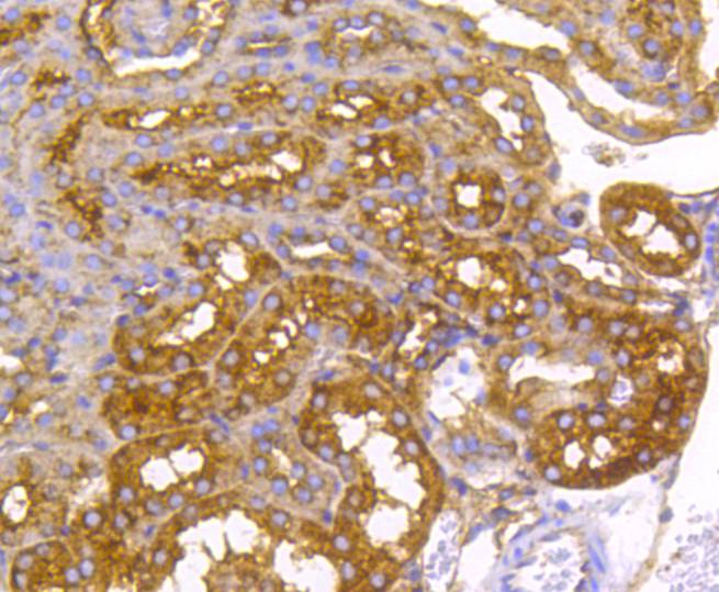 Immunohistochemical analysis of paraffin-embedded mouse kidney tissue using anti-Radixin antibody. The section was pre-treated using heat mediated antigen retrieval with Tris-EDTA buffer (pH 8.0-8.4) for 20 minutes.The tissues were blocked in 5% BSA for 30 minutes at room temperature, washed with ddH2O and PBS, and then probed with the primary antibody (ET1610-41, 1/50) for 30 minutes at room temperature. The detection was performed using an HRP conjugated compact polymer system. DAB was used as the chromogen. Tissues were counterstained with hematoxylin and mounted with DPX.
