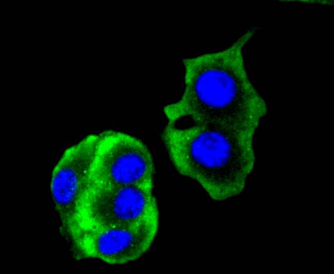 ICC staining of Cytokeratin 14 in B16F1 cells (green). Formalin fixed cells were permeabilized with 0.1% Triton X-100 in TBS for 10 minutes at room temperature and blocked with 1% Blocker BSA for 15 minutes at room temperature. Cells were probed with the primary antibody (ET1610-42, 1/50) for 1 hour at room temperature, washed with PBS. Alexa Fluor®488 Goat anti-Rabbit IgG was used as the secondary antibody at 1/1,000 dilution. The nuclear counter stain is DAPI (blue).