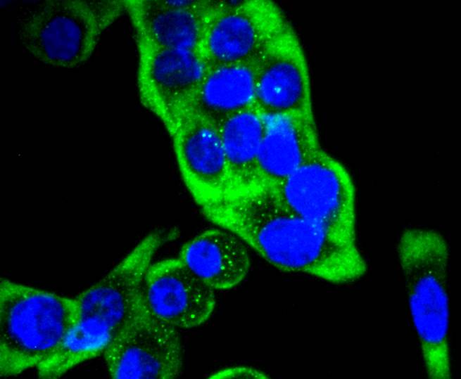 ICC staining of Cytokeratin 14 in SW480 cells (green). Formalin fixed cells were permeabilized with 0.1% Triton X-100 in TBS for 10 minutes at room temperature and blocked with 1% Blocker BSA for 15 minutes at room temperature. Cells were probed with the primary antibody (ET1610-42, 1/50) for 1 hour at room temperature, washed with PBS. Alexa Fluor®488 Goat anti-Rabbit IgG was used as the secondary antibody at 1/1,000 dilution. The nuclear counter stain is DAPI (blue).