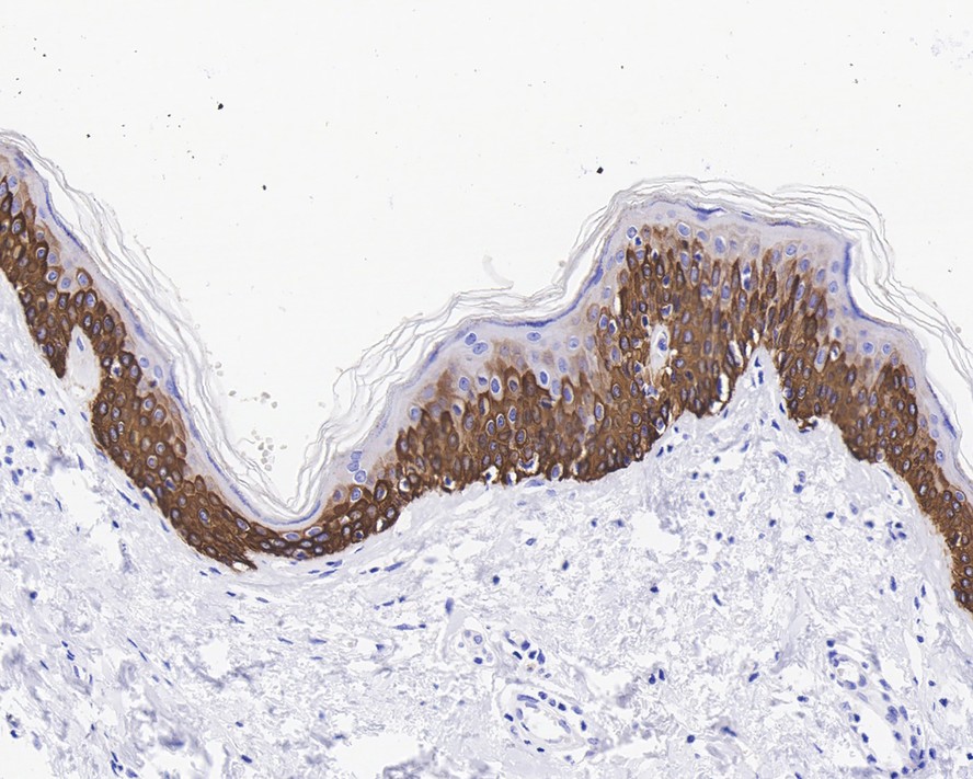 Immunohistochemical analysis of paraffin-embedded mouse skin tissue using anti-Cytokeratin 14 antibody. The section was pre-treated using heat mediated antigen retrieval with Tris-EDTA buffer (pH 8.0-8.4) for 20 minutes.The tissues were blocked in 5% BSA for 30 minutes at room temperature, washed with ddH2O and PBS, and then probed with the primary antibody (ET1610-42, 1/50) for 30 minutes at room temperature. The detection was performed using an HRP conjugated compact polymer system. DAB was used as the chromogen. Tissues were counterstained with hematoxylin and mounted with DPX.