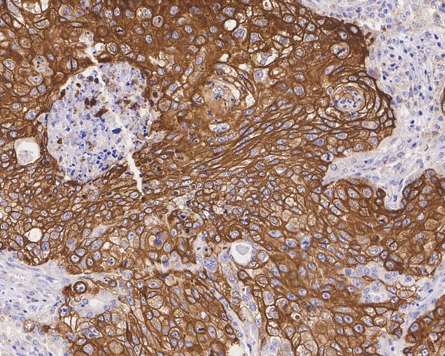 Immunohistochemical analysis of paraffin-embedded human skin tissue using anti-Cytokeratin 5 antibody. The section was pre-treated using heat mediated antigen retrieval with Tris-EDTA buffer (pH 9.0) for 20 minutes.The tissues were blocked in 5% BSA for 30 minutes at room temperature, washed with ddH2O and PBS, and then probed with the primary antibody (ET1610-43, 1/200) for 30 minutes at room temperature. The detection was performed using an HRP conjugated compact polymer system. DAB was used as the chromogen. Tissues were counterstained with hematoxylin and mounted with DPX.