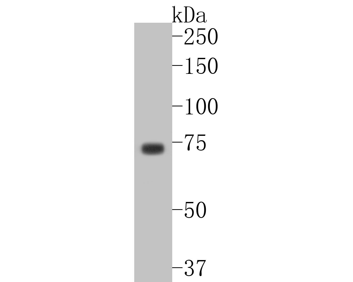 Western blot analysis of p63 on A431 cell lysates. Proteins were transferred to a PVDF membrane and blocked with 5% BSA in PBS for 1 hour at room temperature. The primary antibody (ET1610-44, 1/500) was used in 5% BSA at room temperature for 2 hours. Goat Anti-Rabbit IgG - HRP Secondary Antibody (HA1001) at 1:5,000 dilution was used for 1 hour at room temperature.