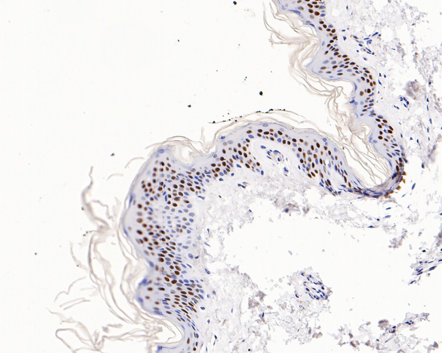 Immunohistochemical analysis of paraffin-embedded human skin tissue with Rabbit anti-p63 antibody (ET1610-44) at 1/800 dilution.<br />
<br />
The section was pre-treated using heat mediated antigen retrieval with sodium citrate buffer (pH 6.0) for 2 minutes. The tissues were blocked in 1% BSA for 20 minutes at room temperature, washed with ddH2O and PBS, and then probed with the primary antibody (ET1610-44) at 1/800 dilution for 1 hour at room temperature. The detection was performed using an HRP conjugated compact polymer system. DAB was used as the chromogen. Tissues were counterstained with hematoxylin and mounted with DPX.