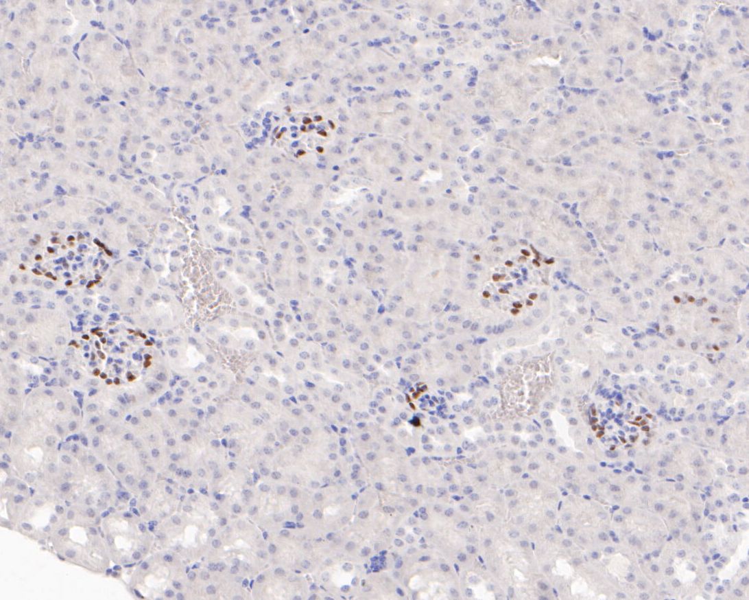 ICC staining of Wilms Tumor Protein in PC-3M cells (green). Formalin fixed cells were permeabilized with 0.1% Triton X-100 in TBS for 10 minutes at room temperature and blocked with 1% Blocker BSA for 15 minutes at room temperature. Cells were probed with the primary antibody (ET1610-45, 1/50) for 1 hour at room temperature, washed with PBS. Alexa Fluor®488 Goat anti-Rabbit IgG was used as the secondary antibody at 1/1,000 dilution. The nuclear counter stain is DAPI (blue).