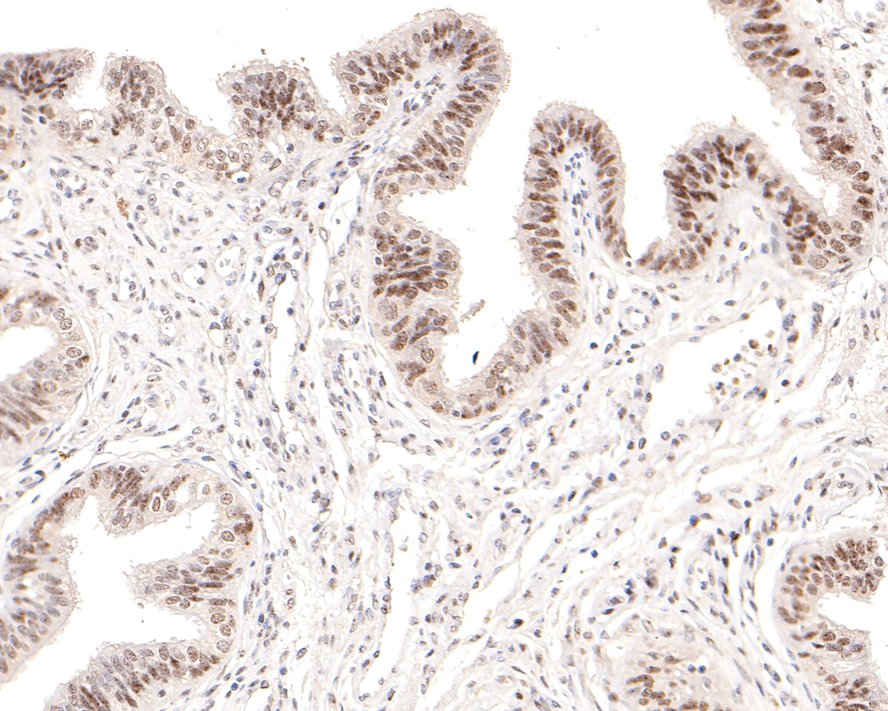 Immunohistochemical analysis of paraffin-embedded mouse kidney tissue using anti-Wilms Tumor Protein antibody. The section was pre-treated using heat mediated antigen retrieval with sodium citrate buffer (pH 6.0) for 20 minutes. The tissues were blocked in 5% BSA for 30 minutes at room temperature, washed with ddH2O and PBS, and then probed with the primary antibody (ET1610-45, 1/50)  for 30 minutes at room temperature. The detection was performed using an HRP conjugated compact polymer system. DAB was used as the chromogen. Tissues were counterstained with hematoxylin and mounted with DPX.