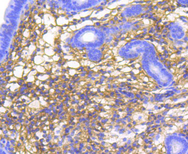 Immunohistochemical analysis of paraffin-embedded mouse uterus tissue using anti-alpha 1 Catenin antibody. The section was pre-treated using heat mediated antigen retrieval with Tris-EDTA buffer (pH 8.0-8.4) for 20 minutes.The tissues were blocked in 5% BSA for 30 minutes at room temperature, washed with ddH2O and PBS, and then probed with the primary antibody (ET1610-46, 1/50) for 30 minutes at room temperature. The detection was performed using an HRP conjugated compact polymer system. DAB was used as the chromogen. Tissues were counterstained with hematoxylin and mounted with DPX.