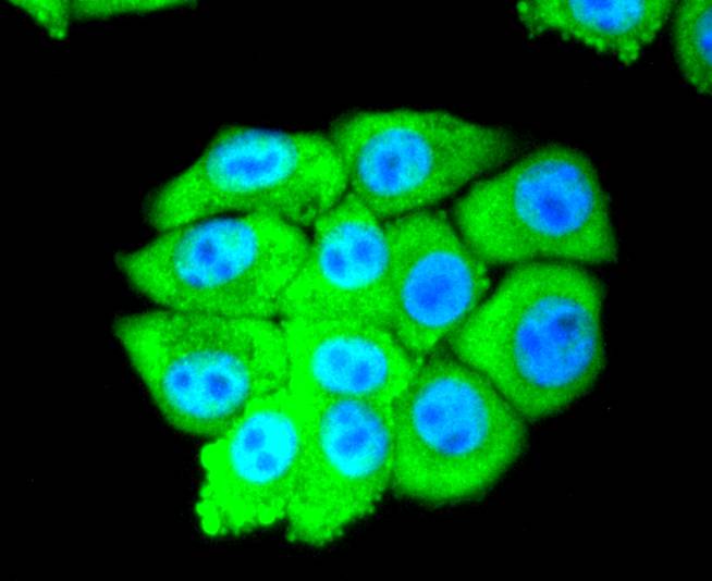 ICC staining of eIF5A in HepG2 cells (green). Formalin fixed cells were permeabilized with 0.1% Triton X-100 in TBS for 10 minutes at room temperature and blocked with 1% Blocker BSA for 15 minutes at room temperature. Cells were probed with the primary antibody (ET1610-49, 1/50) for 1 hour at room temperature, washed with PBS. Alexa Fluor®488 Goat anti-Rabbit IgG was used as the secondary antibody at 1/1,000 dilution. The nuclear counter stain is DAPI (blue).