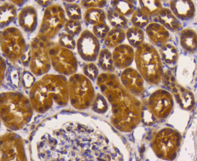 Immunohistochemical analysis of paraffin-embedded human kidney tissue using anti-eIF5A antibody. The section was pre-treated using heat mediated antigen retrieval with Tris-EDTA buffer (pH 8.0-8.4) for 20 minutes.The tissues were blocked in 5% BSA for 30 minutes at room temperature, washed with ddH2O and PBS, and then probed with the primary antibody (ET1610-49, 1/50) for 30 minutes at room temperature. The detection was performed using an HRP conjugated compact polymer system. DAB was used as the chromogen. Tissues were counterstained with hematoxylin and mounted with DPX.