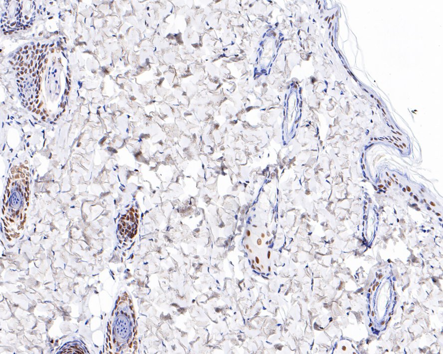 Immunohistochemical analysis of paraffin-embedded rat skin tissue with Rabbit anti-HDAC3 antibody (ET1610-5) at 1/200 dilution.<br />
<br />
The section was pre-treated using heat mediated antigen retrieval with sodium citrate buffer (pH 6.0) for 2 minutes. The tissues were blocked in 1% BSA for 20 minutes at room temperature, washed with ddH2O and PBS, and then probed with the primary antibody (ET1610-5) at 1/200 dilution for 1 hour at room temperature. The detection was performed using an HRP conjugated compact polymer system. DAB was used as the chromogen. Tissues were counterstained with hematoxylin and mounted with DPX.