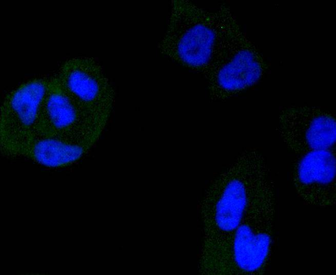 ICC staining of HDAC3 in Hela cells (green). Formalin fixed cells were permeabilized with 0.1% Triton X-100 in TBS for 10 minutes at room temperature and blocked with 1% Blocker BSA for 15 minutes at room temperature. Cells were probed with the primary antibody (ET1610-5, 1/50) for 1 hour at room temperature, washed with PBS. Alexa Fluor®488 Goat anti-Rabbit IgG was used as the secondary antibody at 1/1,000 dilution. The nuclear counter stain is DAPI (blue).