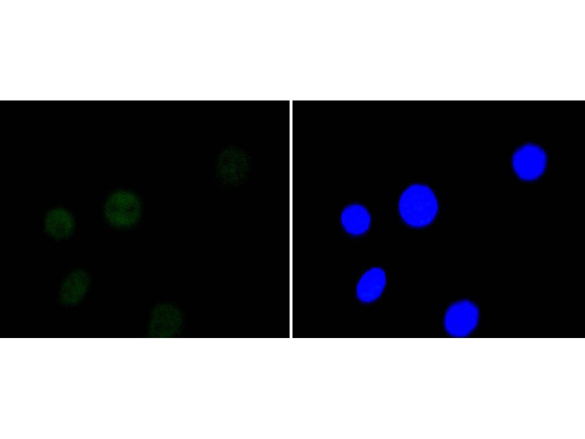 ICC staining of HDAC3 in NIH/3T3 cells (green). Formalin fixed cells were permeabilized with 0.1% Triton X-100 in TBS for 10 minutes at room temperature and blocked with 1% Blocker BSA for 15 minutes at room temperature. Cells were probed with the primary antibody (ET1610-5, 1/50) for 1 hour at room temperature, washed with PBS. Alexa Fluor®488 Goat anti-Rabbit IgG was used as the secondary antibody at 1/1,000 dilution. The nuclear counter stain is DAPI (blue).