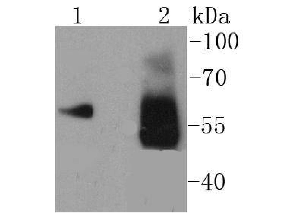 Western blot analysis of Asparagine synthetase on different lysates. Proteins were transferred to a PVDF membrane and blocked with 5% BSA in PBS for 1 hour at room temperature. The primary antibody (ET1610-50, 1/500) was used in 5% BSA at room temperature for 2 hours. Goat Anti-Rabbit IgG - HRP Secondary Antibody (HA1001) at 1:200,000 dilution was used for 1 hour at room temperature.<br />
Positive control: <br />
Lane 1: K562 cell lysate<br />
Lane 2: Human skeletal muscle tissue lysate