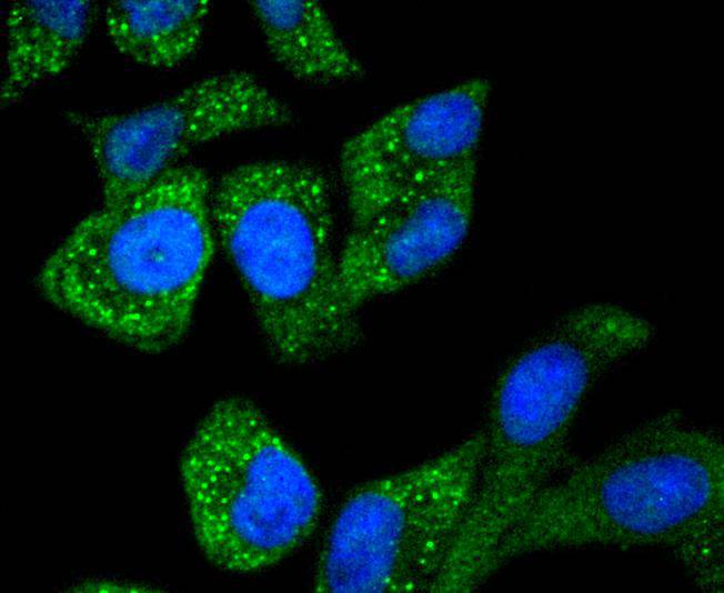 ICC staining of Asparagine synthetase in Hela cells (green). Formalin fixed cells were permeabilized with 0.1% Triton X-100 in TBS for 10 minutes at room temperature and blocked with 1% Blocker BSA for 15 minutes at room temperature. Cells were probed with the primary antibody (ET1610-50, 1/50) for 1 hour at room temperature, washed with PBS. Alexa Fluor®488 Goat anti-Rabbit IgG was used as the secondary antibody at 1/1,000 dilution. The nuclear counter stain is DAPI (blue).