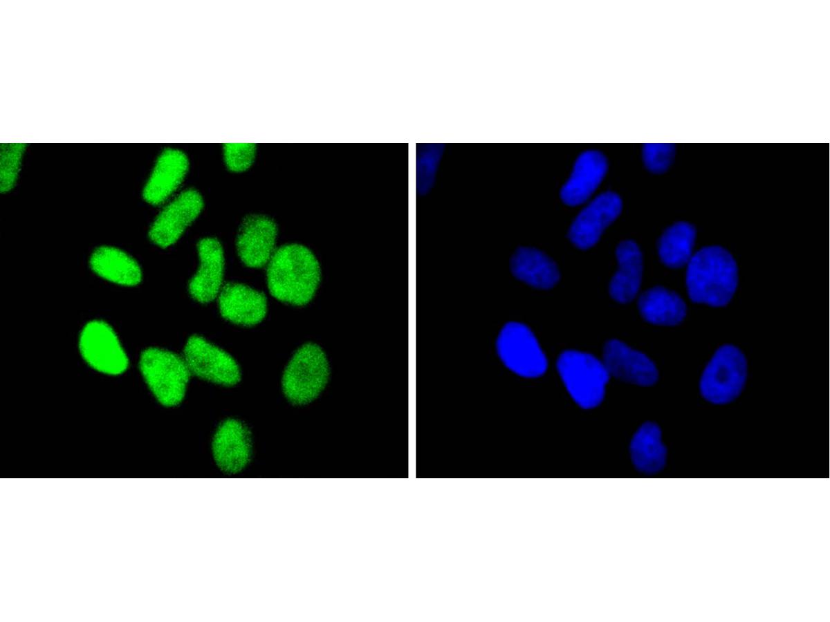 ICC staining of Chk2 in Hela cells (green). Formalin fixed cells were permeabilized with 0.1% Triton X-100 in TBS for 10 minutes at room temperature and blocked with 1% Blocker BSA for 15 minutes at room temperature. Cells were probed with the primary antibody (ET1610-52, 1/50) for 1 hour at room temperature, washed with PBS. Alexa Fluor®488 Goat anti-Rabbit IgG was used as the secondary antibody at 1/1,000 dilution. The nuclear counter stain is DAPI (blue).