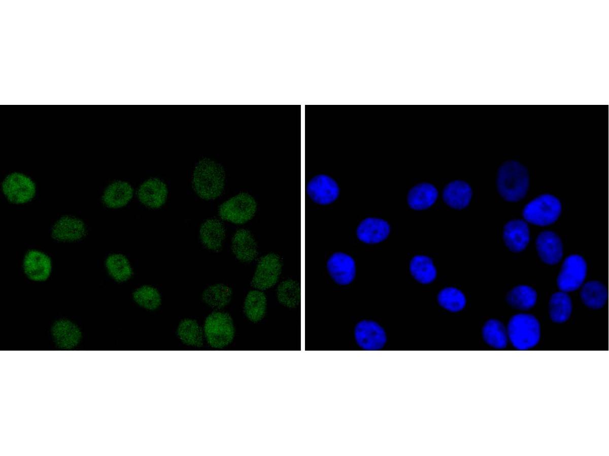 ICC staining of Chk2 in MCF-7 cells (green). Formalin fixed cells were permeabilized with 0.1% Triton X-100 in TBS for 10 minutes at room temperature and blocked with 1% Blocker BSA for 15 minutes at room temperature. Cells were probed with the primary antibody (ET1610-52, 1/50) for 1 hour at room temperature, washed with PBS. Alexa Fluor®488 Goat anti-Rabbit IgG was used as the secondary antibody at 1/1,000 dilution. The nuclear counter stain is DAPI (blue).