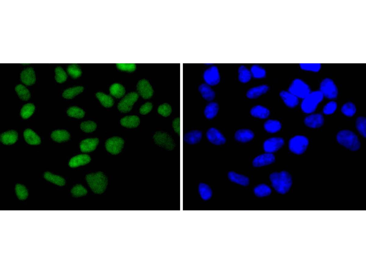 ICC staining of Chk2 in 293 cells (green). Formalin fixed cells were permeabilized with 0.1% Triton X-100 in TBS for 10 minutes at room temperature and blocked with 1% Blocker BSA for 15 minutes at room temperature. Cells were probed with the primary antibody (ET1610-52, 1/50) for 1 hour at room temperature, washed with PBS. Alexa Fluor®488 Goat anti-Rabbit IgG was used as the secondary antibody at 1/1,000 dilution. The nuclear counter stain is DAPI (blue).