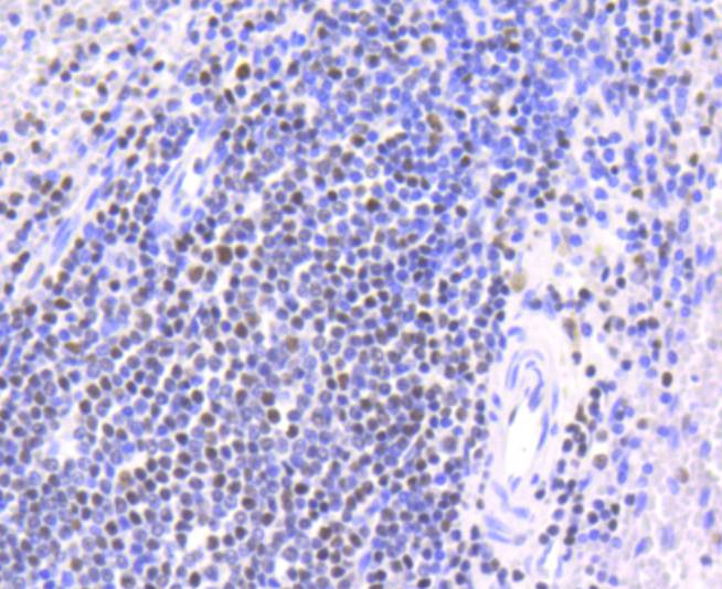 Immunohistochemical analysis of paraffin-embedded human spleen tissue using anti-Chk2 antibody. The section was pre-treated using heat mediated antigen retrieval with Tris-EDTA buffer (pH 8.0-8.4) for 20 minutes.The tissues were blocked in 5% BSA for 30 minutes at room temperature, washed with ddH2O and PBS, and then probed with the primary antibody (ET1610-52, 1/50) for 30 minutes at room temperature. The detection was performed using an HRP conjugated compact polymer system. DAB was used as the chromogen. Tissues were counterstained with hematoxylin and mounted with DPX.