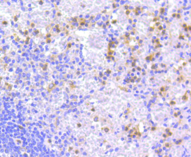 ICC staining of Apg7 in HepG2 cells (green). Formalin fixed cells were permeabilized with 0.1% Triton X-100 in TBS for 10 minutes at room temperature and blocked with 1% Blocker BSA for 15 minutes at room temperature. Cells were probed with the primary antibody (ET1610-53, 1/100) for 1 hour at room temperature, washed with PBS. Alexa Fluor®488 Goat anti-Rabbit IgG was used as the secondary antibody at 1/1,000 dilution. The nuclear counter stain is DAPI (blue).