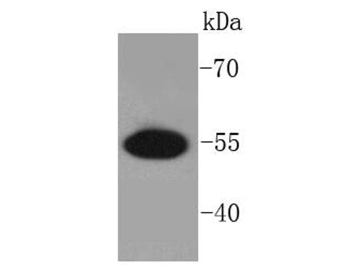 Western blot analysis of PRP19 on Jurkat cells lysates using anti-PRP19 antibody at 1/1,000 dilution.