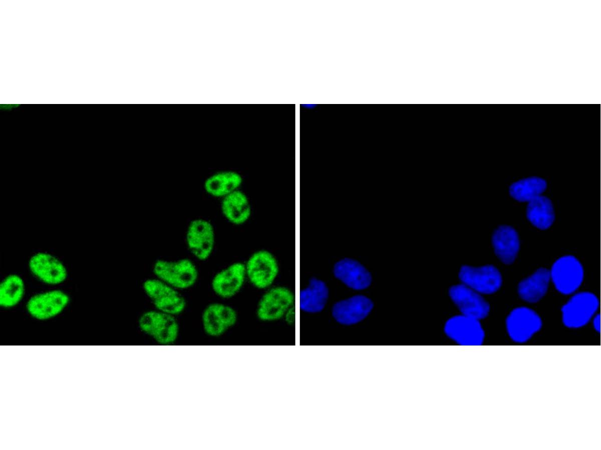 ICC staining PRP19 in Hela cells (green). The nuclear counter stain is DAPI (blue). Cells were fixed in paraformaldehyde, permeabilised with 0.25% Triton X100/PBS.