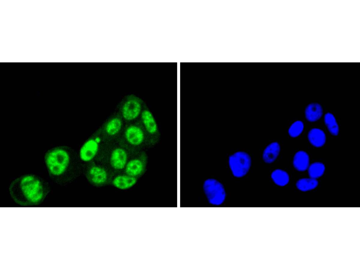 ICC staining PRP19 in MCF-7 cells (green). The nuclear counter stain is DAPI (blue). Cells were fixed in paraformaldehyde, permeabilised with 0.25% Triton X100/PBS.