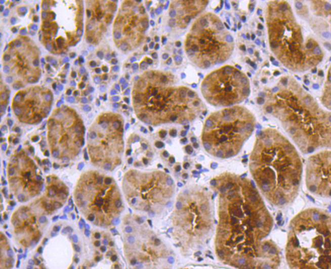 Immunohistochemical analysis of paraffin-embedded human kidney tissue using anti-PRP19 antibody. Counter stained with hematoxylin.