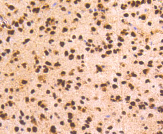Immunohistochemical analysis of paraffin-embedded mouse brain tissue using anti-PRP19 antibody. Counter stained with hematoxylin.