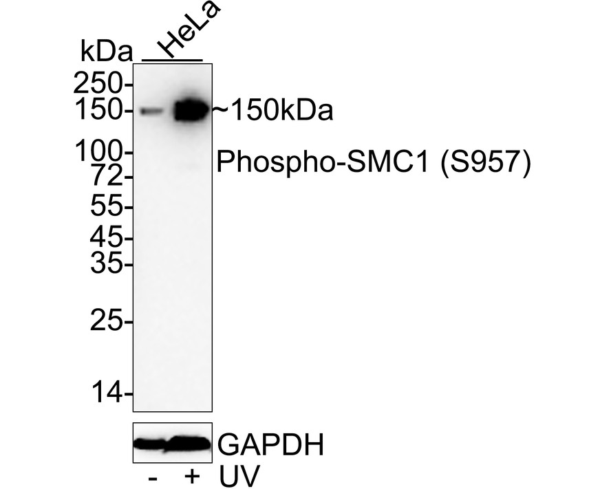 Western blot analysis of Phospho-SMC1(S957) on different lysates. Proteins were transferred to a PVDF membrane and blocked with 5% BSA in PBS for 1 hour at room temperature. The primary antibody (ET1610-55, 1/500) was used in 5% BSA at room temperature for 2 hours. Goat Anti-Rabbit IgG - HRP Secondary Antibody (HA1001) at 1:200,000 dilution was used for 1 hour at room temperature.<br />
Positive control: <br />
Lane 1: Hela cell lysate<br />
Lane 2: 293T cell lysate